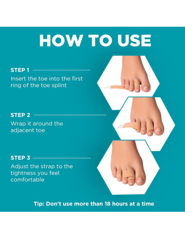 Corrector de dedos en martillo Homergy 4 unidades beige