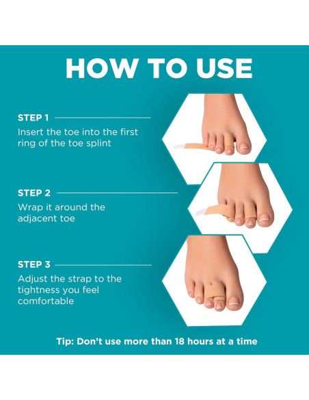 Corrector de dedos en martillo Homergy 4 unidades beige