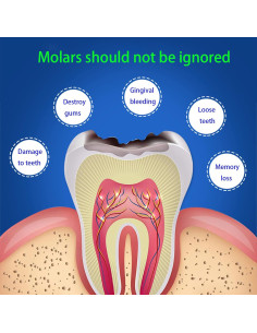 Protector Bucal Nocturno SAMOKA 4 PCS Ajustable 80g 2