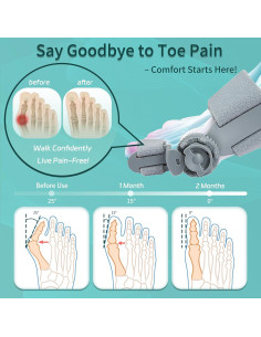Corrector de Juanetes Ajustable Veook Gris para Pies 2