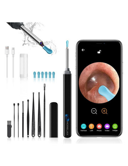 Kit de Eliminación de Cerumen Morelax con Cámara 1080P