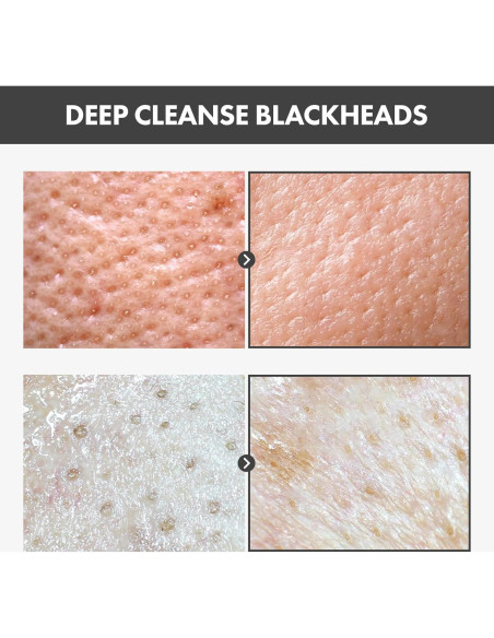 Mascarilla Peel Off TOSOWOONG Carbón 50g - Eliminación Puntos Negros