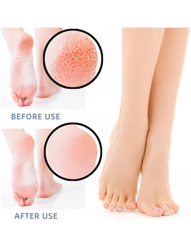 Protectores de Talón de Silicona ENA - 4 Pares para Alivio