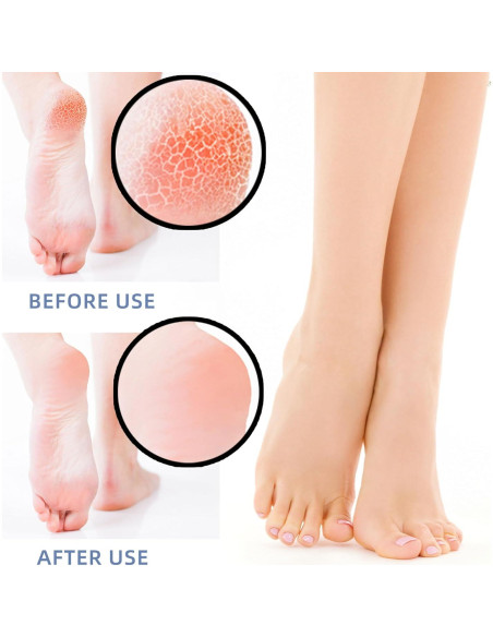 Protectores de Talón de Silicona ENA - 4 Pares para Alivio