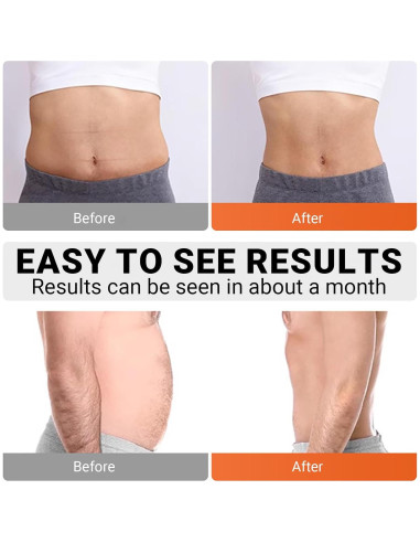 Estimulador de Abdominales Innocareer EMS 10 Modos 30 Niveles