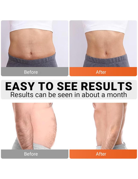 Estimulador de Abdominales Innocareer EMS 10 Modos 30 Niveles