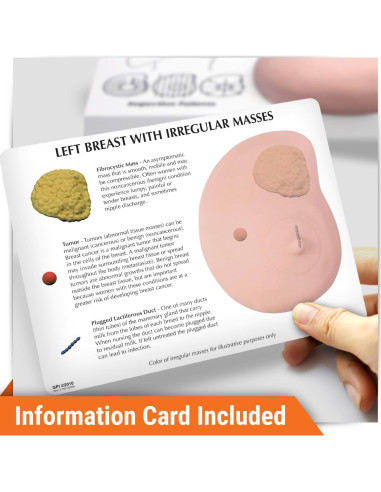 Modelo de Anatomía Humana de Mama Izquierda GPI Anatomicals