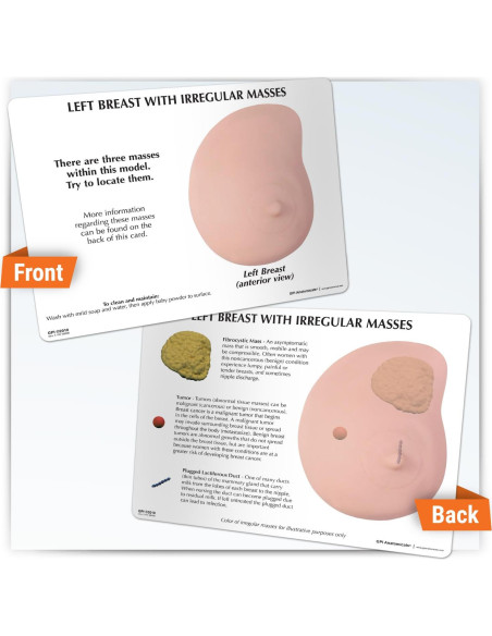 Modelo de Anatomía Humana de Mama Izquierda GPI Anatomicals