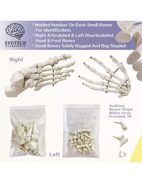 Esqueleto Humano Desarticulado Evotech 170 cm para Anatomía