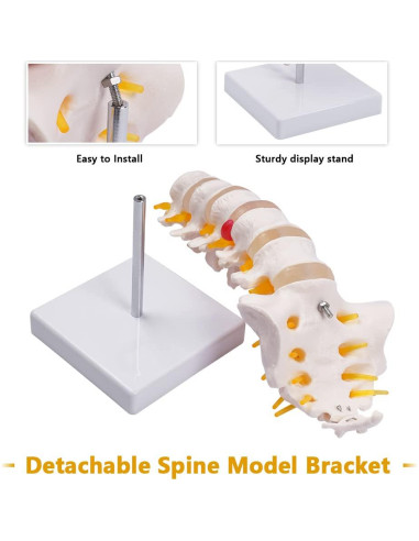 Columna Lumbar Anatómica Breesky 5 Vértebras con Sacro