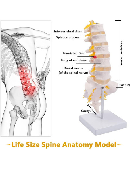 Columna Lumbar Anatómica Breesky 5 Vértebras con Sacro