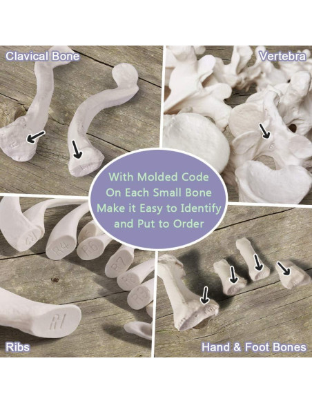 Esqueleto Humano Desarticulado Evotech 170 cm para Anatomía