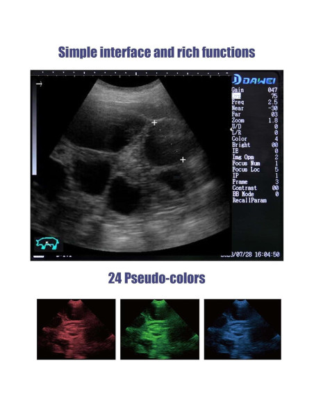 Máquina de Ultrasonido Veterinario DAWEI S1 con Sonda Micro-Cóncava Máquina de Ultrasonido Veterinario DAWEI S1 con Sonda Micro-Cóncava