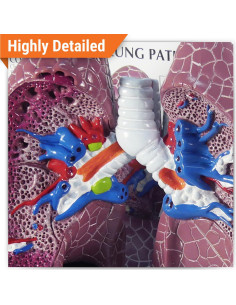 Modelo de Pulmón con Patologías GPI Anatomicals 28.6x28.6cm 2