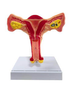 Modelo Anatómico de Útero y Ovario Femenino Feleolibe 24x12x20CM