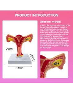 Modelo Anatómico de Útero y Ovario Femenino Feleolibe 24x12x20CM 2