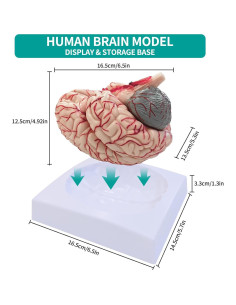 Modelo Anatómico del Cerebro Humano SFXYJ 8 Partes 15.24x17.02cm 2
