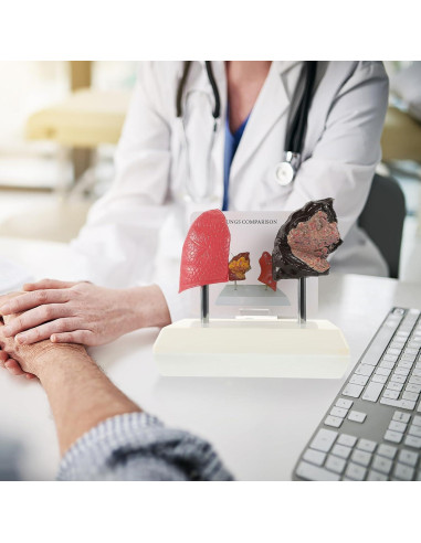 Modelo de Pulmón Hemoton 1:1 Saludable y Fumador PVC