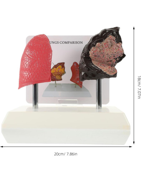 Modelo de Pulmón Hemoton 1:1 Saludable y Fumador PVC