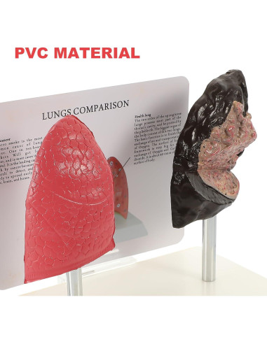 Modelo de Pulmón Hemoton 1:1 Saludable y Fumador PVC