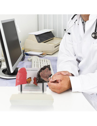 Modelo de Pulmón Hemoton 1:1 Saludable y Fumador PVC