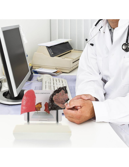 Modelo de Pulmón Hemoton 1:1 Saludable y Fumador PVC