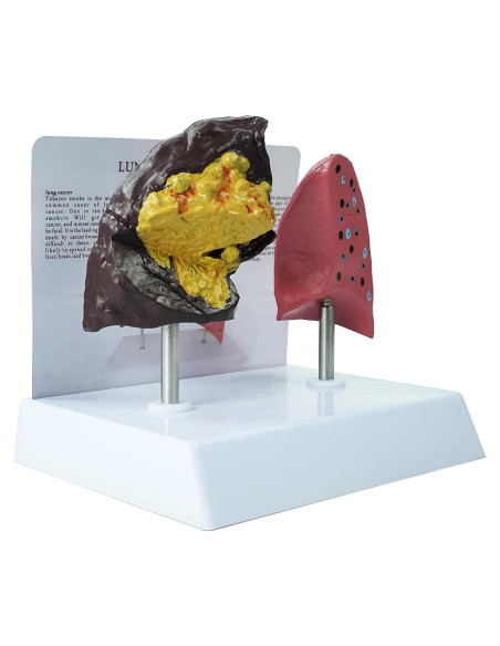 Modelo Anatómico de Pulmón Fumador vs Saludable PVC 21.96x13.99cm Modelo Anatómico de Pulmón Fumador vs Saludable PVC 21.96x13.99cm