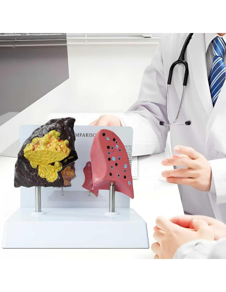 Modelo Anatómico de Pulmón Fumador vs Saludable PVC 21.96x13.99cm Modelo Anatómico de Pulmón Fumador vs Saludable PVC 21.96x13.99cm