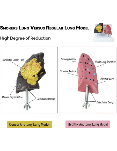 Modelo Anatómico de Pulmón Fumador vs Saludable PVC 21.96x13.99cm Modelo Anatómico de Pulmón Fumador vs Saludable PVC 21.96x13.99cm