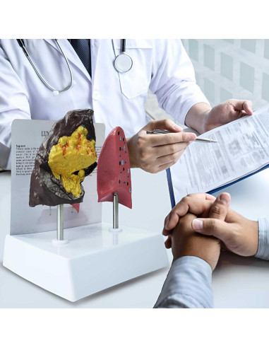 Modelo Anatómico de Pulmón Fumador vs Saludable PVC 21.96x13.99cm