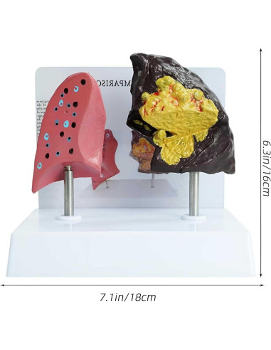 Modelo Anatómico de Pulmón Fumador vs Saludable PVC 21.96x13.99cm