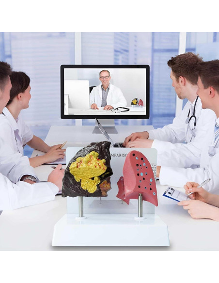 Modelo Anatómico de Pulmón Fumador vs Saludable PVC 21.96x13.99cm Modelo Anatómico de Pulmón Fumador vs Saludable PVC 21.96x13.99cm