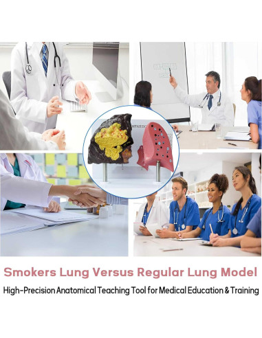 Modelo Anatómico de Pulmón Fumador vs Saludable PVC 21.96x13.99cm