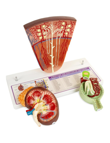 Modelo de Riñón MediTrainer con Nefrona y Glomérulo Humano