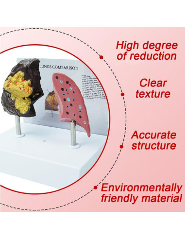 Modelo de Pulmón de Fumador YANHAO y Pulmón Saludable Real