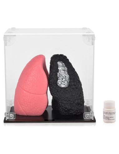 Modelo de Pulmón Saludable vs Fumador Ultrassist Mini 10.9cm