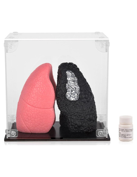 Modelo de Pulmón Saludable vs Fumador Ultrassist Mini 10.9cm