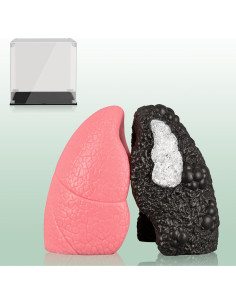 Modelo de Pulmón Saludable vs Fumador Ultrassist Mini 10.9cm 2