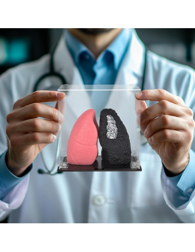 Modelo de Pulmón Saludable vs Fumador Ultrassist Mini 10.9cm