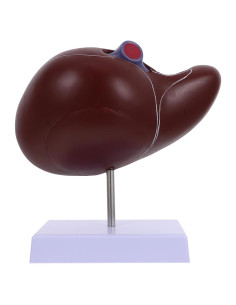 Modelo de Anatomía Humana del Hígado Agrandado TOPPERFUN