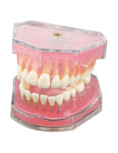 Modelo de Dientes de Demostración Dental Dentalmall 4004 Removibles