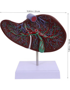 Modelo de Anatomía Humana del Hígado Agrandado TOPPERFUN 2
