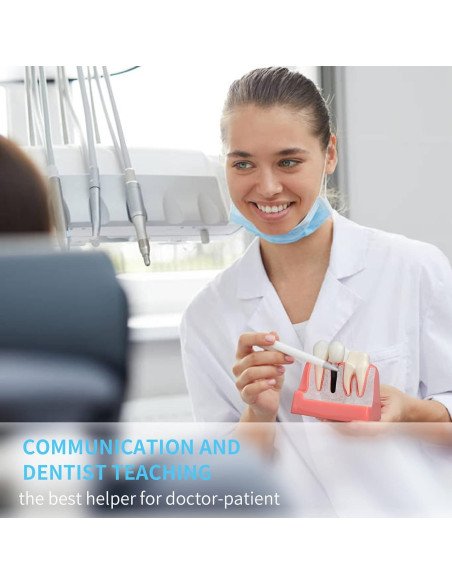 Modelo de Implante Dental ANNWAN 4 Veces Removible para Educación