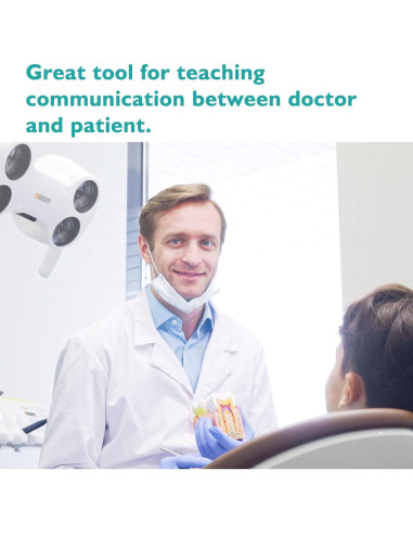 Modelo de Caries Dental LVCHEN 8.7x7.6 cm Resina Educativa