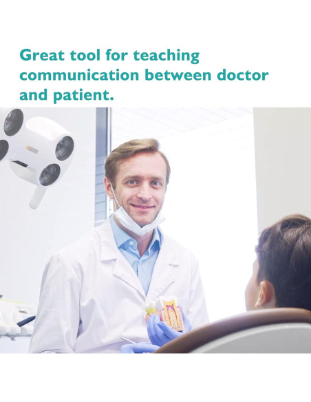 Modelo de Caries Dental LVCHEN 8.7x7.6 cm Resina Educativa Modelo de Caries Dental LVCHEN 8.7x7.6 cm Resina Educativa