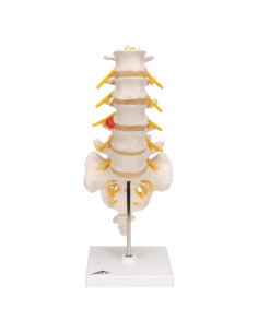 Columna Vertebral Lumbar 3B Scientific A76/5 con Disco Prolapsado 34 cm