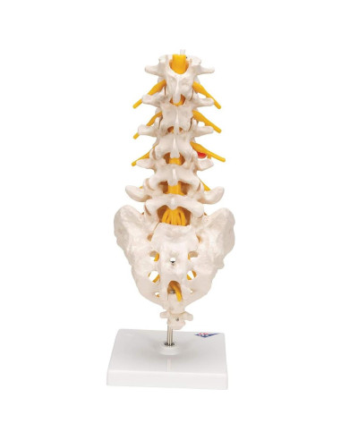 Columna Vertebral Lumbar 3B Scientific A76/5 con Disco Prolapsado 34 cm
