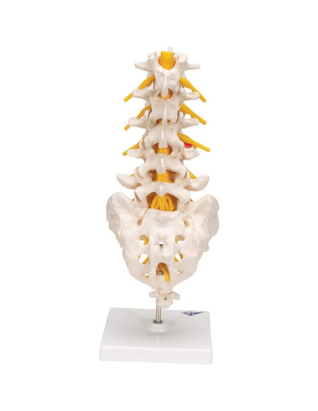 Columna Vertebral Lumbar 3B Scientific A76/5 con Disco Prolapsado 34 cm