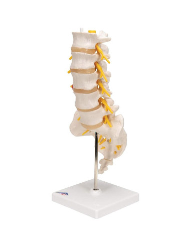 Columna Vertebral Lumbar 3B Scientific A76/5 con Disco Prolapsado 34 cm