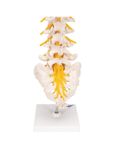 Columna Vertebral Lumbar 3B Scientific A76/5 con Disco Prolapsado 34 cm